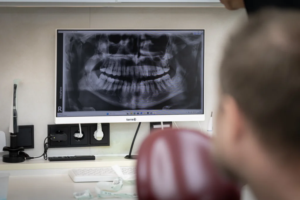 Kieferchirurgie Bad Oldesloe: Panoramaröntgenbild am Monitor im Behandlungszimmer
