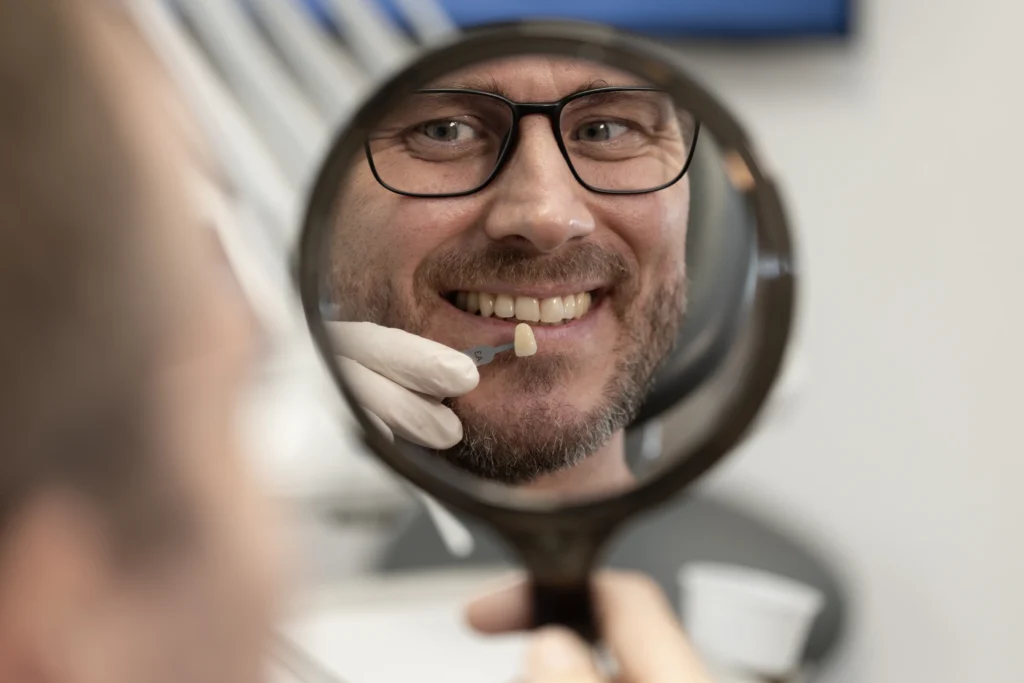 Ergebnis im Spiegel mit Farbmuster, Veneers beim Zahnarzt in Bad Oldesloe