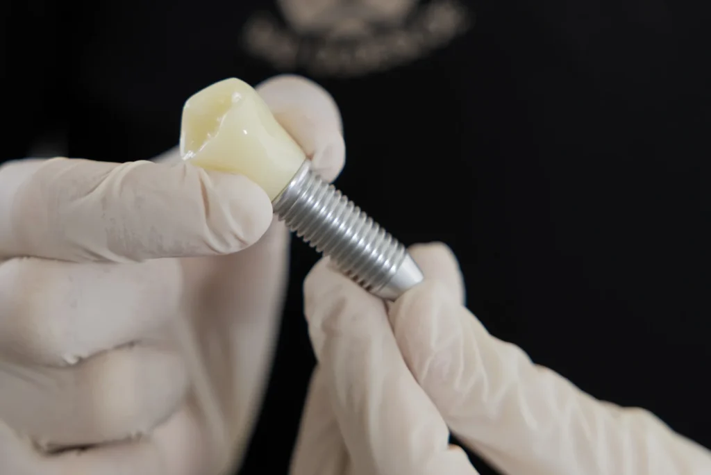 Nahaufnahme von Implantat und Krone, Zahnimplantate Bad Oldesloe